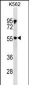 PDPK1 Antibody