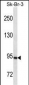 PGR/PR Antibody (Ascites)