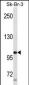 PGR/PR Antibody