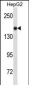 NCAM1 Antibody (Ascites)