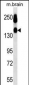 NCAM1 Antibody (Ascites)