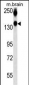 NCAM1 Antibody