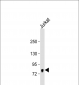 EIF4B  Antibody