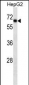 SOX9 Antibody (Ascites)