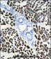 ACTA1 Antibody