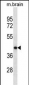 POU5F1 Antibody (Ascites)