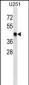 SNX6  Antibody