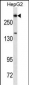 Dicer1 Antibody (Ascites)