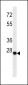 Kappa light chain Antibody