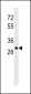 Lambda light chain Antibody