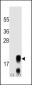 FSHB/FSH Antibody (Center)