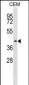 IHH Antibody (C-term) (Ascites)