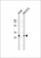 THAP11 Antibody (Center) (Ascites)