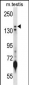 JARID1B Antibody (N-term)