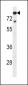 TDT Antibody (N-term)