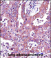 JAK2 Antibody (Center)