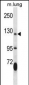 JAK2 Antibody (Center)