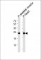 MYL3 Antibody (N-term)