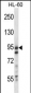 USP20 Antibody (Center)