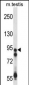 USP20 Antibody (Center)