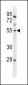 ETV6 Antibody (Center)