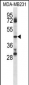 CD84 Antibody (C-term)