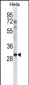 NHEJ1 Antibody (C-term)