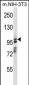 ASAP1 Antibody (Center)