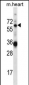 GATAD2B Antibody (N-term)