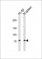 PRDM1 Antibody (N-term)