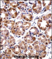 POLI Antibody (C-term)