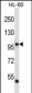 POLI Antibody (C-term)