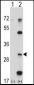 PSMB5 Antibody (C-term)