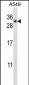 RAB11A Antibody (Center)