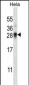 SNRPN Antibody (N-term)