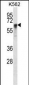 NXF1 Antibody (N-term)