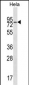 WASF2 Antibody (Center)