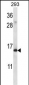 RPS19 Antibody (C-term)