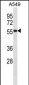 SEMG1 Antibody (N-term)