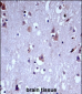 KCNC1 Antibody (C-term)