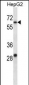 KCNC1 Antibody (C-term)