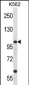 KCNC3 Antibody (C-term)