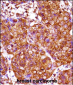 IRX3 Antibody (N-term)
