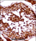 HSFX1 Antibody (Center)