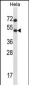 HSFX1 Antibody (Center)