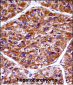 EIF2AK3 Antibody (N-term)