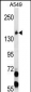 EIF2AK3 Antibody (N-term)