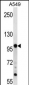 TPX2 Antibody (Center)