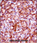 RIPK3 Antibody (C-term)