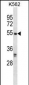 RIPK3 Antibody (C-term)